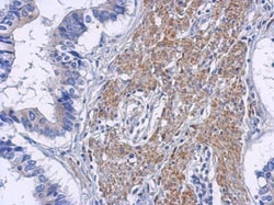 Invitrogen RIP2 Polyclonal Antibody 100 &mu;L; Unconjugated:Antibodies,