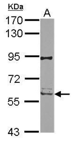 Invitrogen RIP2 Polyclonal Antibody 100 &mu;L; Unconjugated:Antibodies,