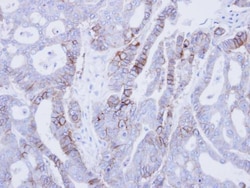 Invitrogen EpCAM Polyclonal Antibody 100 &mu;L; Unconjugated:Antibodies,