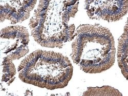 Invitrogen EpCAM Polyclonal Antibody 100 &mu;L; Unconjugated:Antibodies,