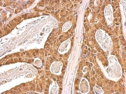 Invitrogen VCP Polyclonal Antibody 100 &mu;L; Unconjugated:Antibodies,