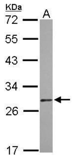 Invitrogen DIABLO Polyclonal Antibody 100 &mu;L | Buy Online | Invitrogen&trade; | Fisher Scientific