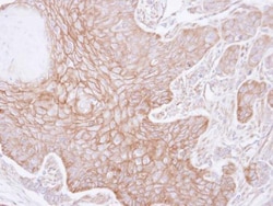 Invitrogen alpha Adducin Polyclonal Antibody 100 &mu;L; Unconjugated:Antibodies,