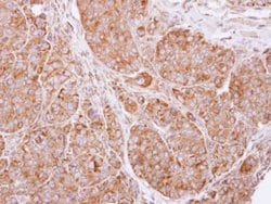 cIAP2 Polyclonal Antibody:Antibodies, Polyclonal