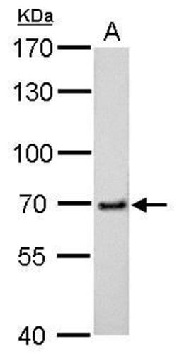 cIAP2 Polyclonal Antibody:Antibodies, Polyclonal