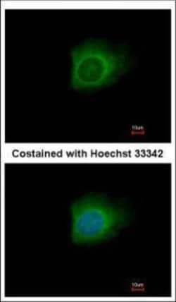 Invitrogen Caspase 10 Polyclonal Antibody 100 &mu;L; Unconjugated:Antibodies,