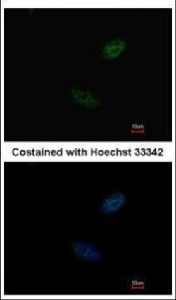 Invitrogen CDX2 Polyclonal Antibody 100 &mu;L | Buy Online | Invitrogen&trade; | Fisher Scientific