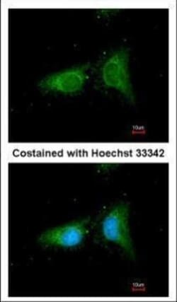 Invitrogen beta COP Polyclonal Antibody 100 &mu;L; Unconjugated:Antibodies,