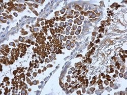 Invitrogen beta COP Polyclonal Antibody 100 &mu;L; Unconjugated:Antibodies,