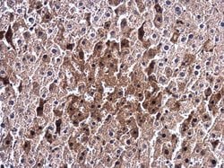 Invitrogen&trade;&nbsp;Ceruloplasmin Polyclonal Antibody