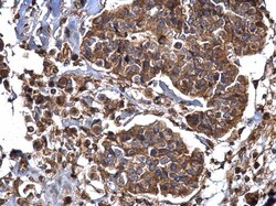 Invitrogen Dynamin 2 Polyclonal Antibody 100 &mu;L; Unconjugated:Antibodies,