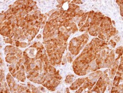 Invitrogen GPI Polyclonal Antibody 100 &mu;L | Buy Online | Invitrogen&trade; | Fisher Scientific