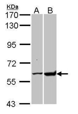 Invitrogen GPI Polyclonal Antibody 100 &mu;L | Buy Online | Invitrogen&trade; | Fisher Scientific