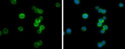 Invitrogen ITK Polyclonal Antibody 100 &mu;L; Unconjugated:Antibodies,