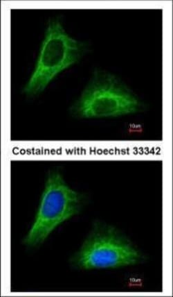 Invitrogen Cytokeratin 5 Polyclonal Antibody 100 &mu;L; Unconjugated:Antibodies,