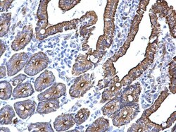 Invitrogen Cytokeratin 5 Polyclonal Antibody 100 &mu;L; Unconjugated:Antibodies,