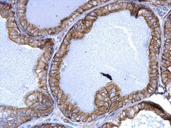 Invitrogen Cytokeratin 5 Polyclonal Antibody 100 &mu;L; Unconjugated:Antibodies,