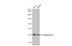 Invitrogen Cytokeratin 5 Polyclonal Antibody 100 &mu;L; Unconjugated:Antibodies,