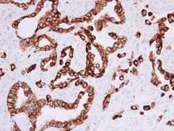Invitrogen Cytokeratin 5 Polyclonal Antibody 100 &mu;L; Unconjugated:Antibodies,