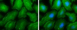 MYH9 Polyclonal Antibody, Invitrogen 100 &mu;L; Unconjugated:Antibodies,