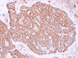 MYH9 Polyclonal Antibody, Invitrogen 100 &mu;L; Unconjugated:Antibodies,