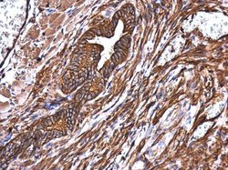 MYH9 Polyclonal Antibody, Invitrogen 100 &mu;L; Unconjugated:Antibodies,