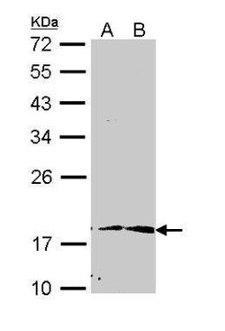 Invitrogen PIN1 Polyclonal Antibody 100 &mu;L; Unconjugated:Antibodies,