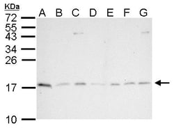 Invitrogen PIN1 Polyclonal Antibody 100 &mu;L; Unconjugated:Antibodies,