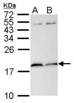 Invitrogen PIN1 Polyclonal Antibody 100 &mu;L; Unconjugated:Antibodies,