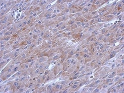 POLG Polyclonal Antibody:Antibodies, Polyclonal