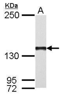 POLG Polyclonal Antibody:Antibodies, Polyclonal