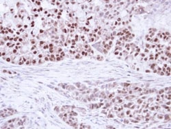 PPAR delta Polyclonal Antibody:Antibodies, Polyclonal