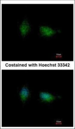 Invitrogen PKC beta Polyclonal Antibody 100 &mu;L; Unconjugated:Antibodies,