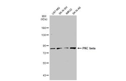 Invitrogen PKC beta Polyclonal Antibody 100 &mu;L; Unconjugated:Antibodies,