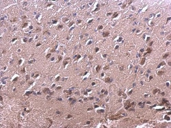 Invitrogen RAC2 Polyclonal Antibody 100 &mu;L; Unconjugated:Antibodies,