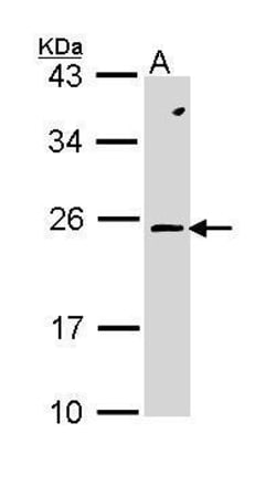 Invitrogen RAC2 Polyclonal Antibody 100 &mu;L; Unconjugated:Antibodies,