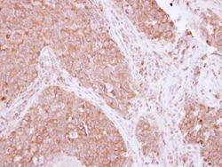 Invitrogen SIAH1 Polyclonal Antibody 100 &mu;L; Unconjugated:Antibodies,