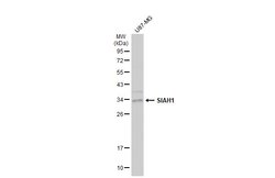 Invitrogen SIAH1 Polyclonal Antibody 100 &mu;L; Unconjugated:Antibodies,