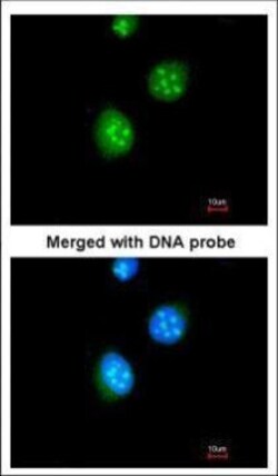 Invitrogen THRB Polyclonal Antibody 100 &mu;L; Unconjugated:Antibodies,