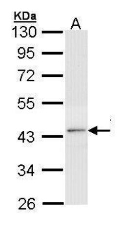 Invitrogen THRB Polyclonal Antibody 100 &mu;L; Unconjugated:Antibodies,