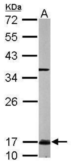 Invitrogen UBC13 Polyclonal Antibody 100 &mu;L; Unconjugated:Antibodies,