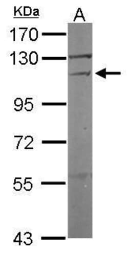 Invitrogen Vinculin Polyclonal Antibody 100 &mu;L; Unconjugated:Antikroppar