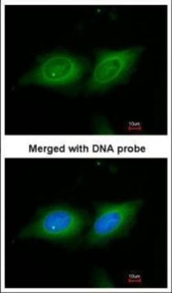 Invitrogen 14-3-3 beta Polyclonal Antibody 100 &mu;L; Unconjugated:Antibodies,