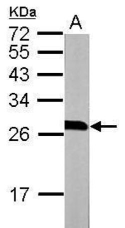 Invitrogen 14-3-3 beta Polyclonal Antibody 100 &mu;L; Unconjugated:Antibodies,
