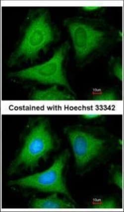 Invitrogen 14-3-3 gamma Polyclonal Antibody 100 &mu;L; Unconjugated:Antibodies,