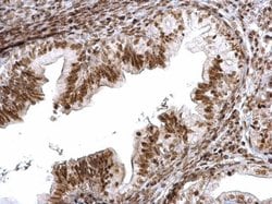 Invitrogen SMC1 Polyclonal Antibody 100 &mu;L; Unconjugated:Antibodies,