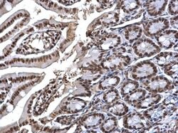 Invitrogen SMC1 Polyclonal Antibody 100 &mu;L; Unconjugated:Antibodies,