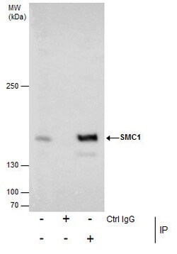 Invitrogen SMC1 Polyclonal Antibody 100 &mu;L | Buy Online | Invitrogen&trade; | Fisher Scientific