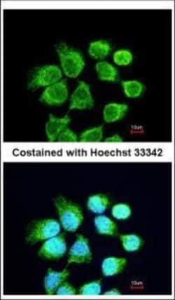 Invitrogen RACGAP1 Polyclonal Antibody 100 &mu;L; Unconjugated:Antibodies,