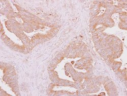 Invitrogen IRAK4 Polyclonal Antibody 100 &mu;L; Unconjugated:Antibodies,